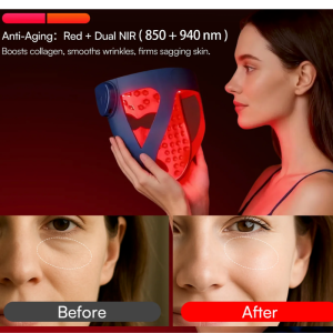 An INIA Glow 4D marketing graphic showing a woman in profile holding the navy blue silicone mask glowing red, paired with a side-by-side before and after facial skin progress photo tracking visible improvements in wrinkles, eye bags, and smile lines over two weeks.