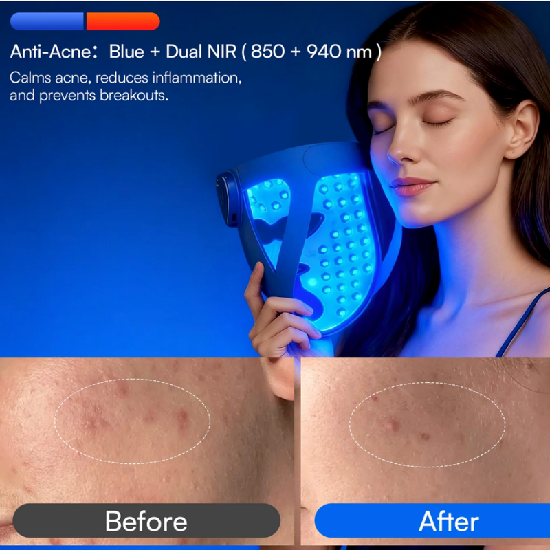 An INIA marketing graphic showing a woman holding the flexible silicone mask glowing blue, paired with a side-by-side skin progress photo showing a reduction in blemishes and acne scars to demonstrate the anti-acne mode utilizing blue plus 850 and 940 nm Dual NIR light