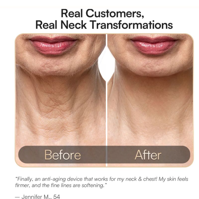 An INIA marketing graphic titled Real Customers Real Neck Transformations, showing a side-by-side before and after skin progress comparison photo of a woman's neck and jawline tracking a visible reduction in lines and creases, paired with a customer review quote below