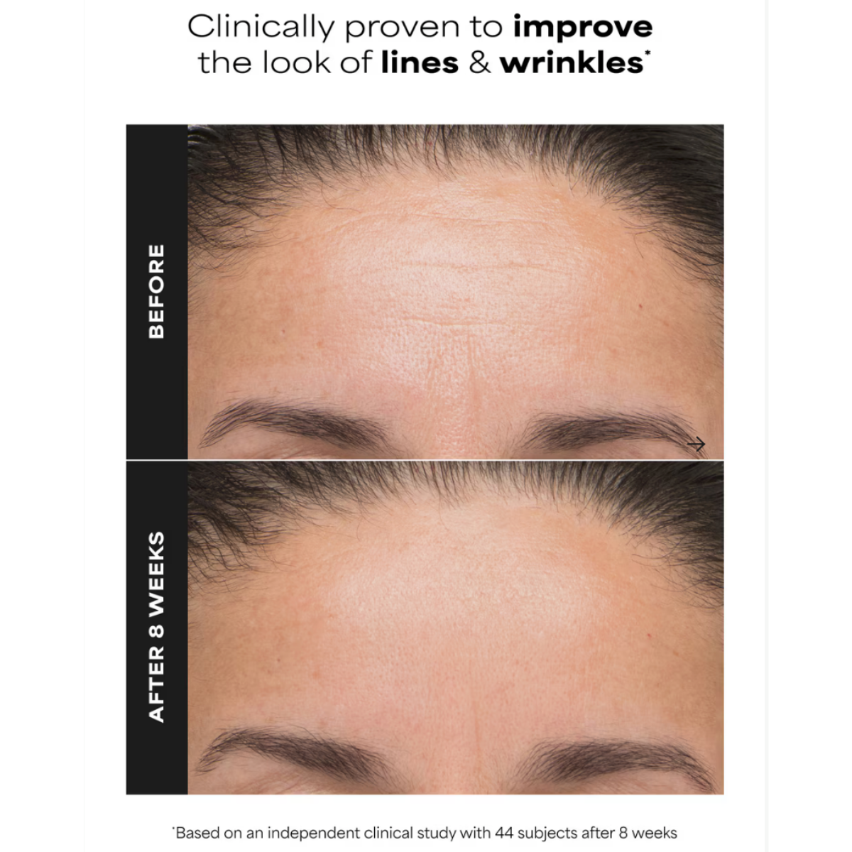 Before-and-after skincare graphic showing a woman's forehead with visible improvement in the look of fine lines and wrinkles after using Paula’s Choice 6% Mandelic + 2% Lactic Acid Liquid Exfoliant.